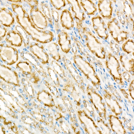 ACOX1 Rabbit mAb