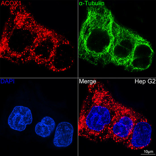 ACOX1 Rabbit mAb