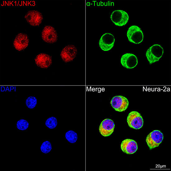 JNK1/2/3 Rabbit mAb