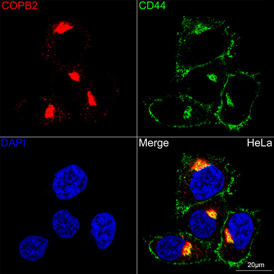 COPB2 Rabbit mAb
