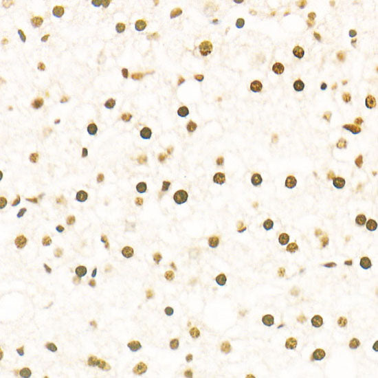 TriMethyl-Histone H3-K27 Rabbit mAb