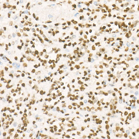 TriMethyl-Histone H3-K27 Rabbit mAb