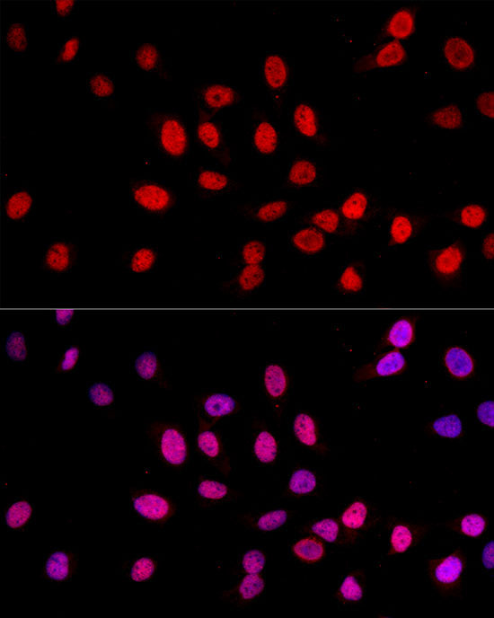 TriMethyl-Histone H3-K27 Rabbit mAb