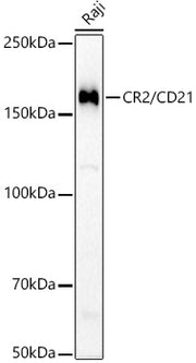 CR2/CD21 Rabbit mAb
