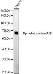 Alpha-Fetoprotein (AFP) Rabbit mAb