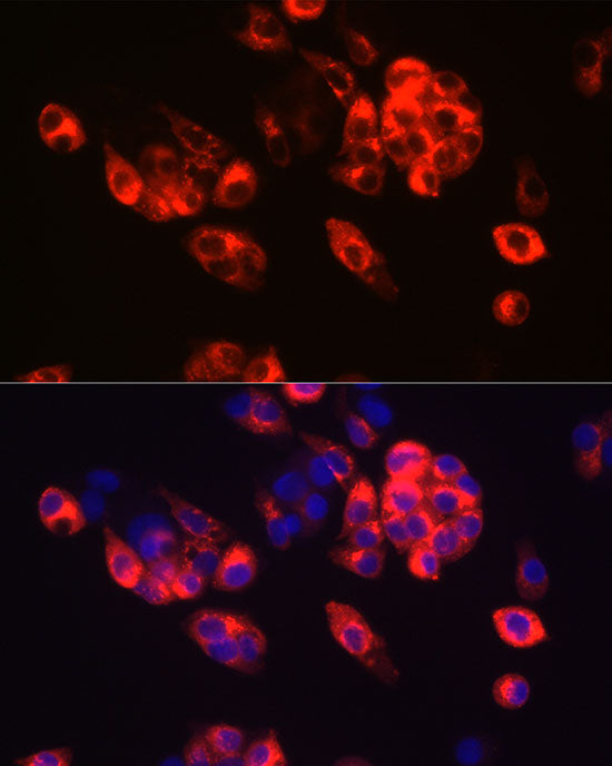 Alpha-Fetoprotein (AFP) Rabbit mAb