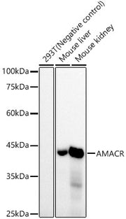 AMACR/p504S Rabbit mAb