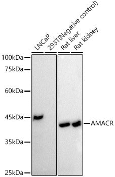 AMACR/p504S Rabbit mAb