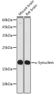 α-Synuclein Rabbit mAb