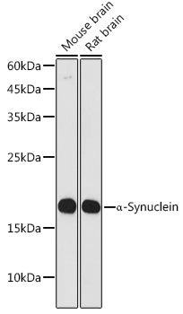 α-Synuclein Rabbit mAb