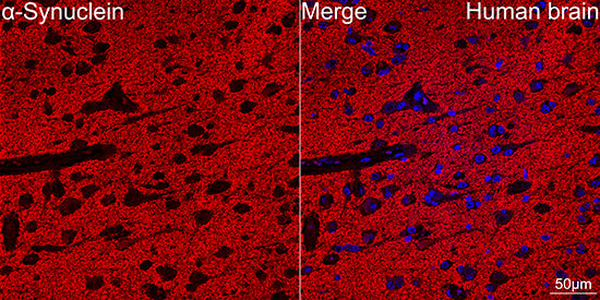 α-Synuclein Rabbit mAb