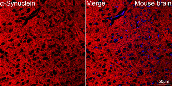 α-Synuclein Rabbit mAb