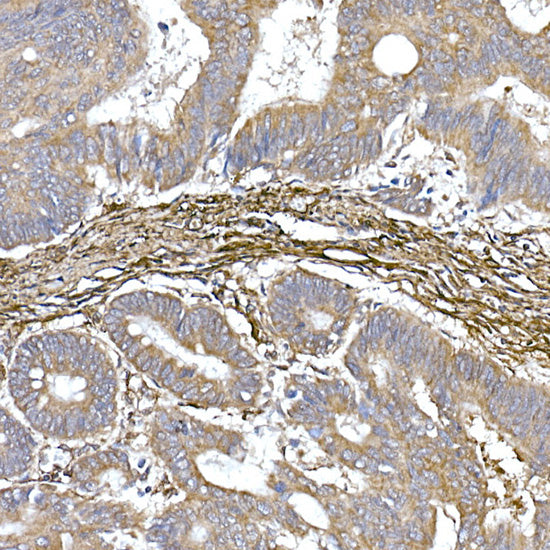 Caveolin-1  Rabbit mAb