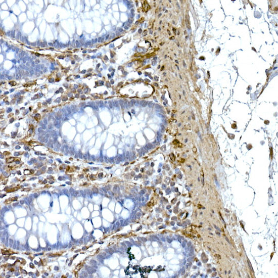 Caveolin-1  Rabbit mAb