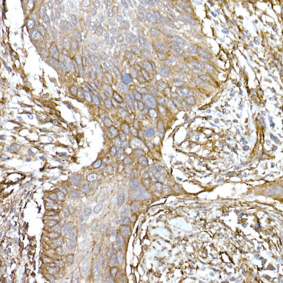 Caveolin-1  Rabbit mAb