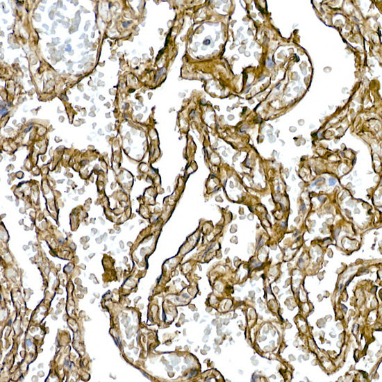 Caveolin-1  Rabbit mAb