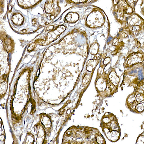 Caveolin-1  Rabbit mAb