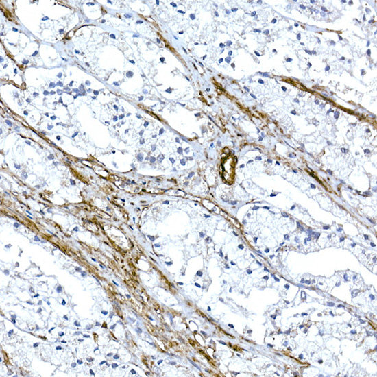 Caveolin-1  Rabbit mAb