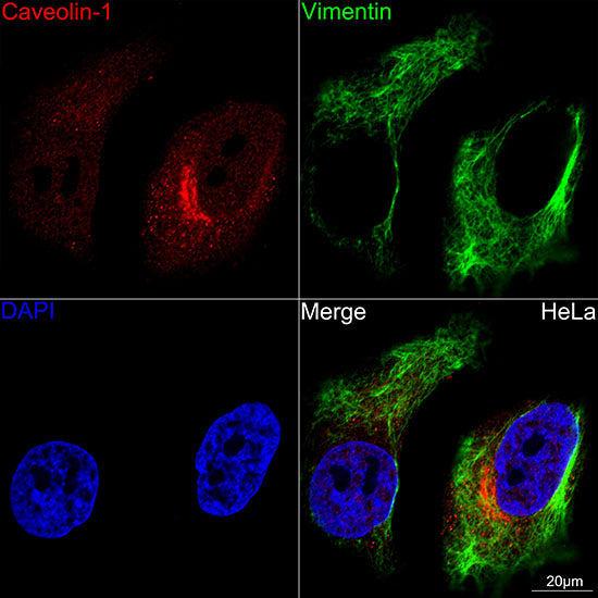 Caveolin-1  Rabbit mAb