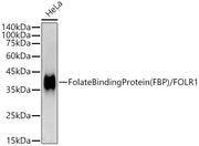 Folate Binding Protein(FBP) / FOLR1 Rabbit mAb