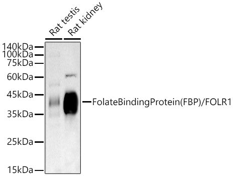 Folate Binding Protein(FBP) / FOLR1 Rabbit mAb