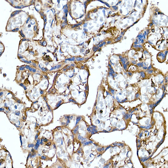 Folate Binding Protein(FBP) / FOLR1 Rabbit mAb
