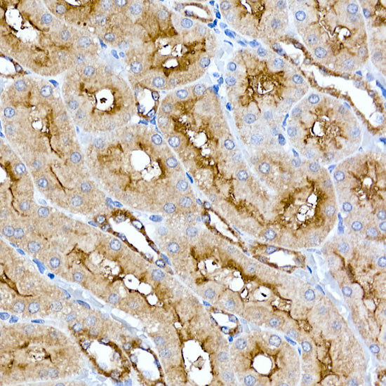 Folate Binding Protein(FBP) / FOLR1 Rabbit mAb
