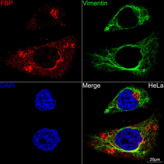 Folate Binding Protein(FBP) / FOLR1 Rabbit mAb