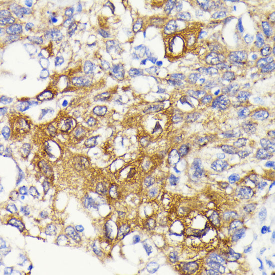 IKKβ Rabbit mAb