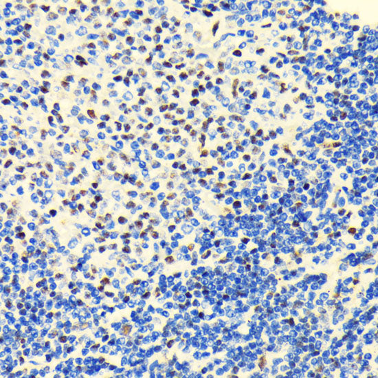 HDAC2 Rabbit mAb