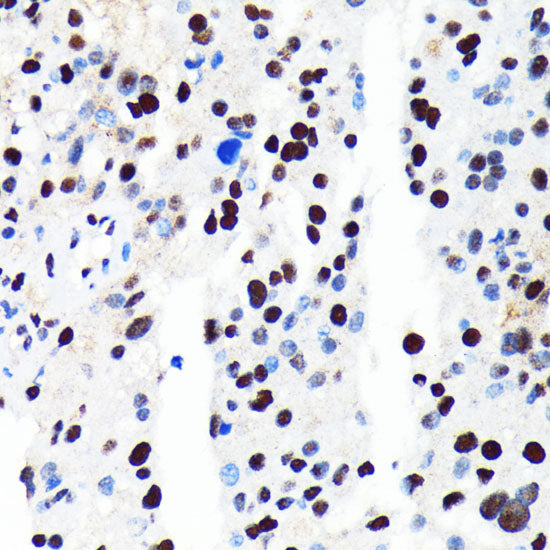 HDAC2 Rabbit mAb