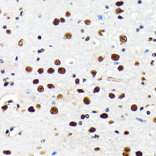 HDAC2 Rabbit mAb