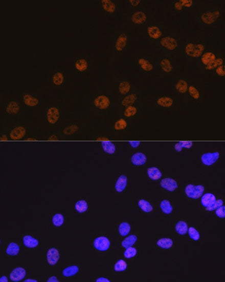 HDAC2 Rabbit mAb