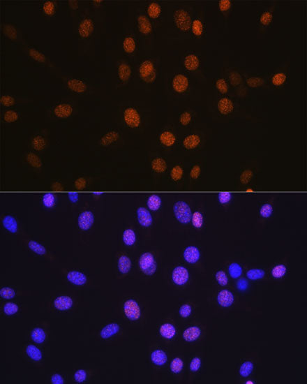 HDAC2 Rabbit mAb