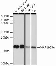 MAP1LC3A Rabbit mAb