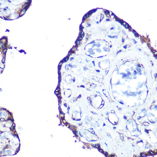 MAP1LC3A Rabbit mAb