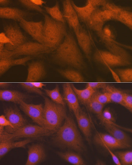 ALKBH1 Rabbit mAb