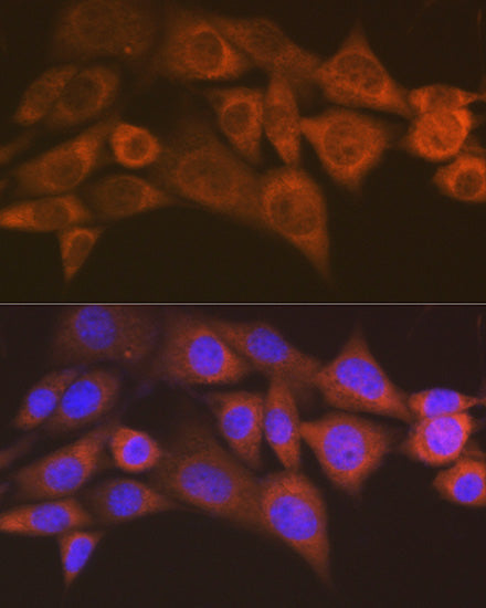 ALKBH1 Rabbit mAb