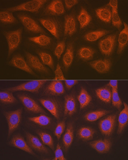 ALKBH1 Rabbit mAb