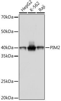 PIM2 Rabbit mAb