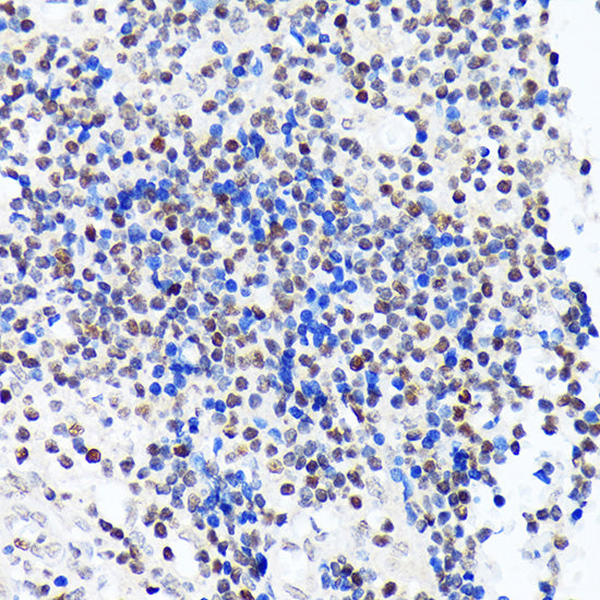 IKZF3 Rabbit mAb