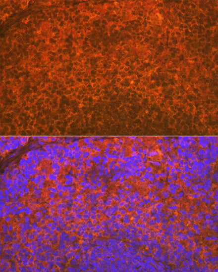 IKZF3 Rabbit mAb