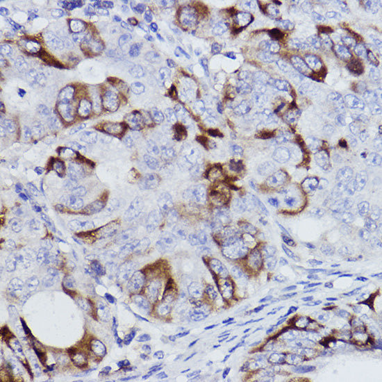 Cyclin B1 Rabbit mAb