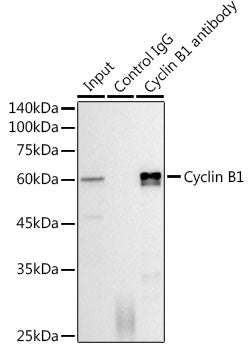 Cyclin B1 Rabbit mAb