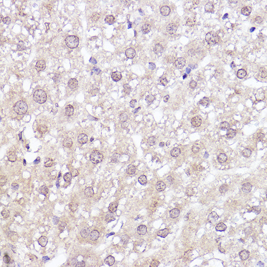MEK1 Rabbit mAb