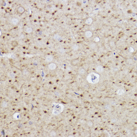 Caspase-6 Rabbit mAb