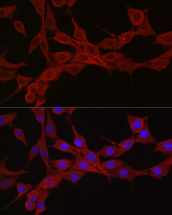 KRAS+HRAS+NRAS Rabbit mAb