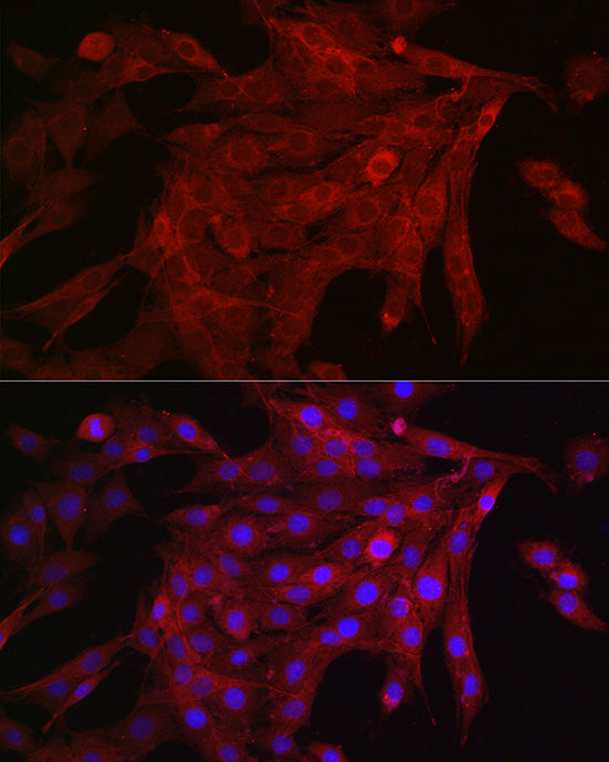 KRAS+HRAS+NRAS Rabbit mAb