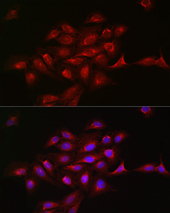 KRAS+HRAS+NRAS Rabbit mAb