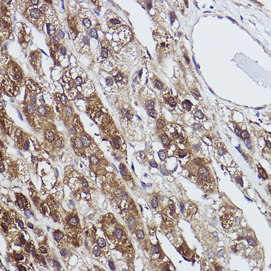 FBP1 Rabbit mAb